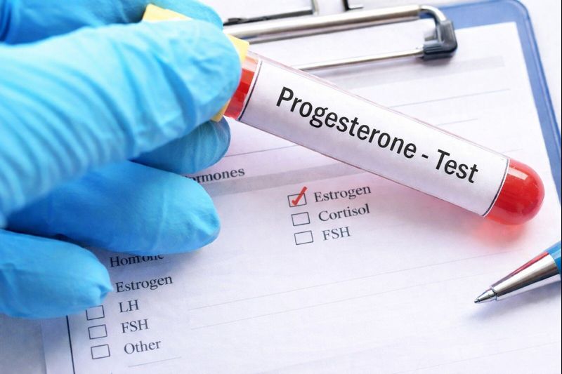 Progesterone Test Explained