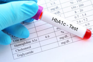 HbA1c blood test symptoms and long term blood sugar monitoring